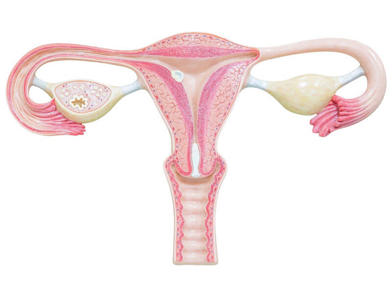 Hiperplasia Endometrial